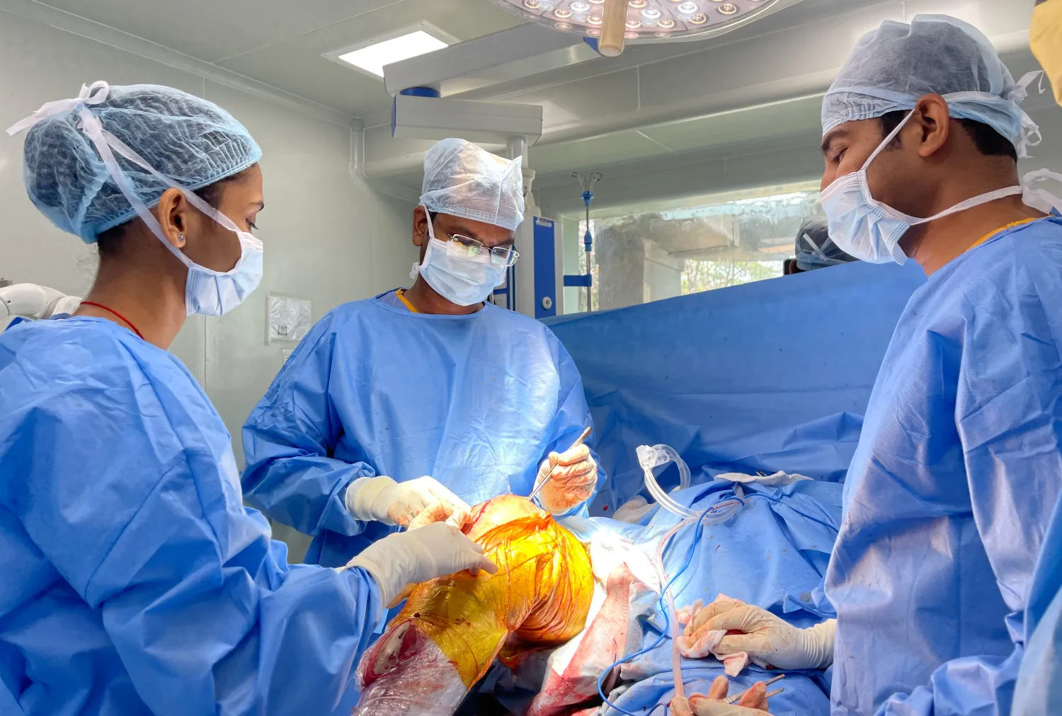 Blog Image - Knee Replacement Surgery Under Yashasvini Insurance in Bangalore — Is It Covered?