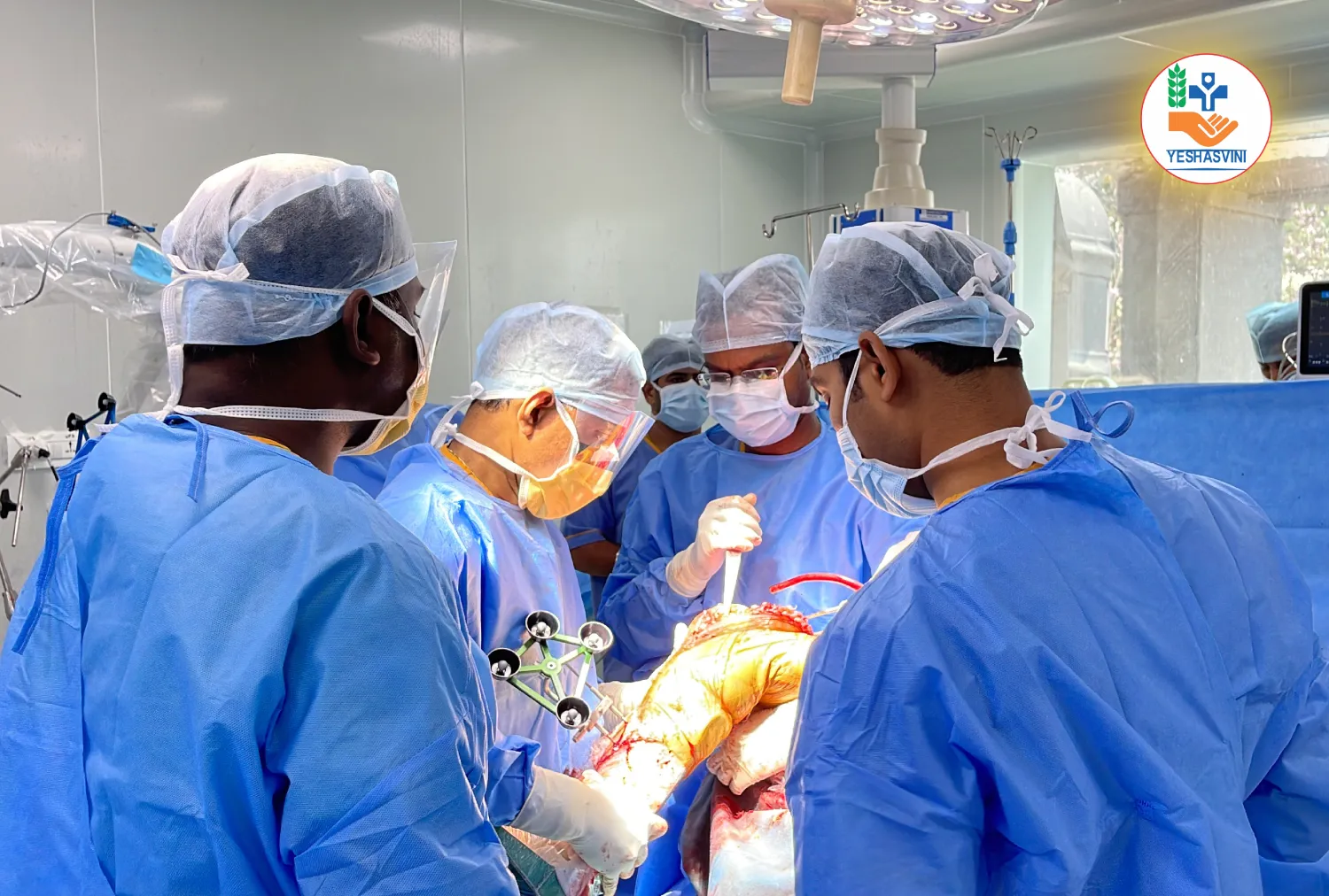Blog Image - Knee Replacement Surgery Under Yashasvini Insurance in Bangalore — Is It Covered?