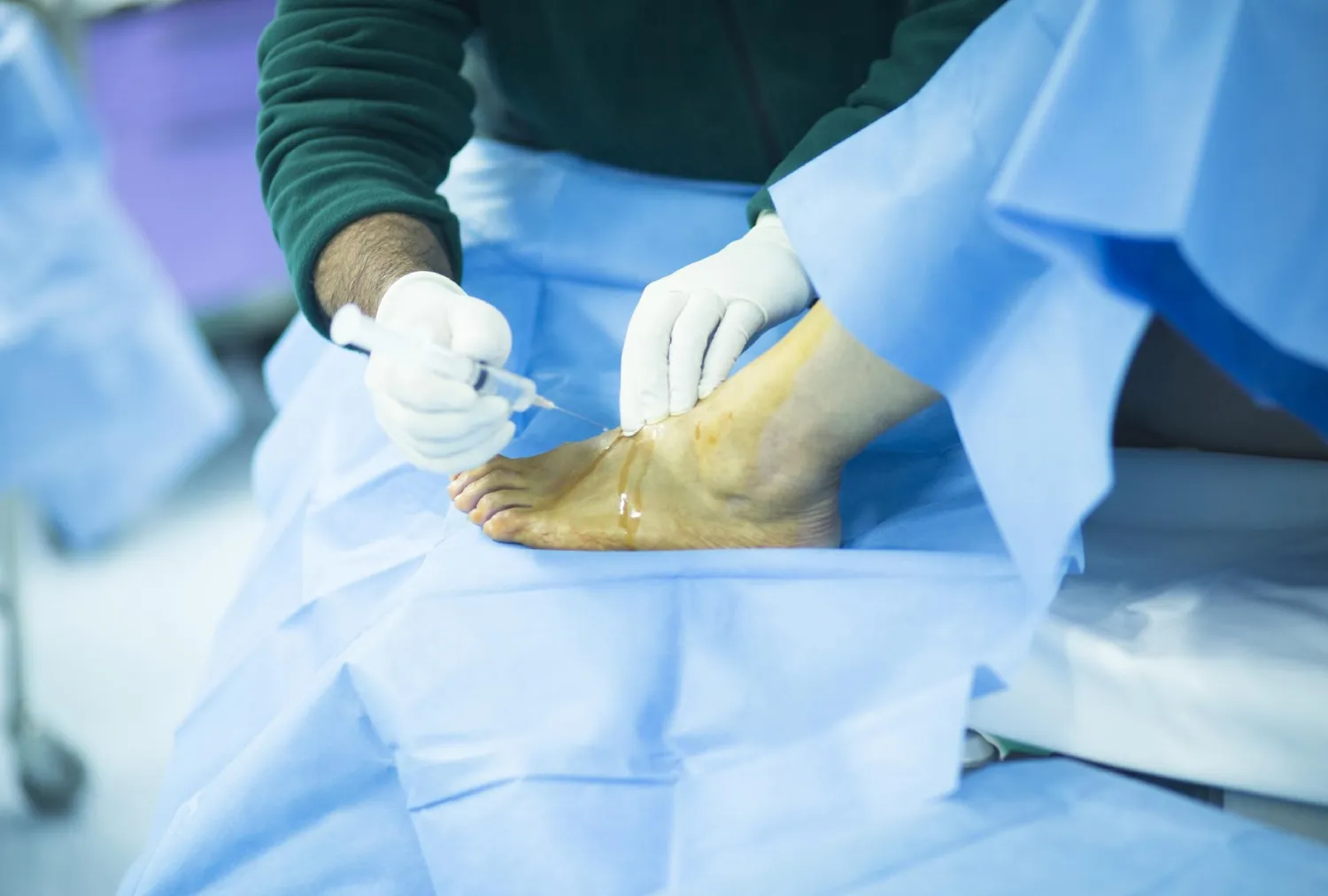 Blog Image - Diabetic Foot Ulcer Treatment in Bangalore: Stages and Prevention