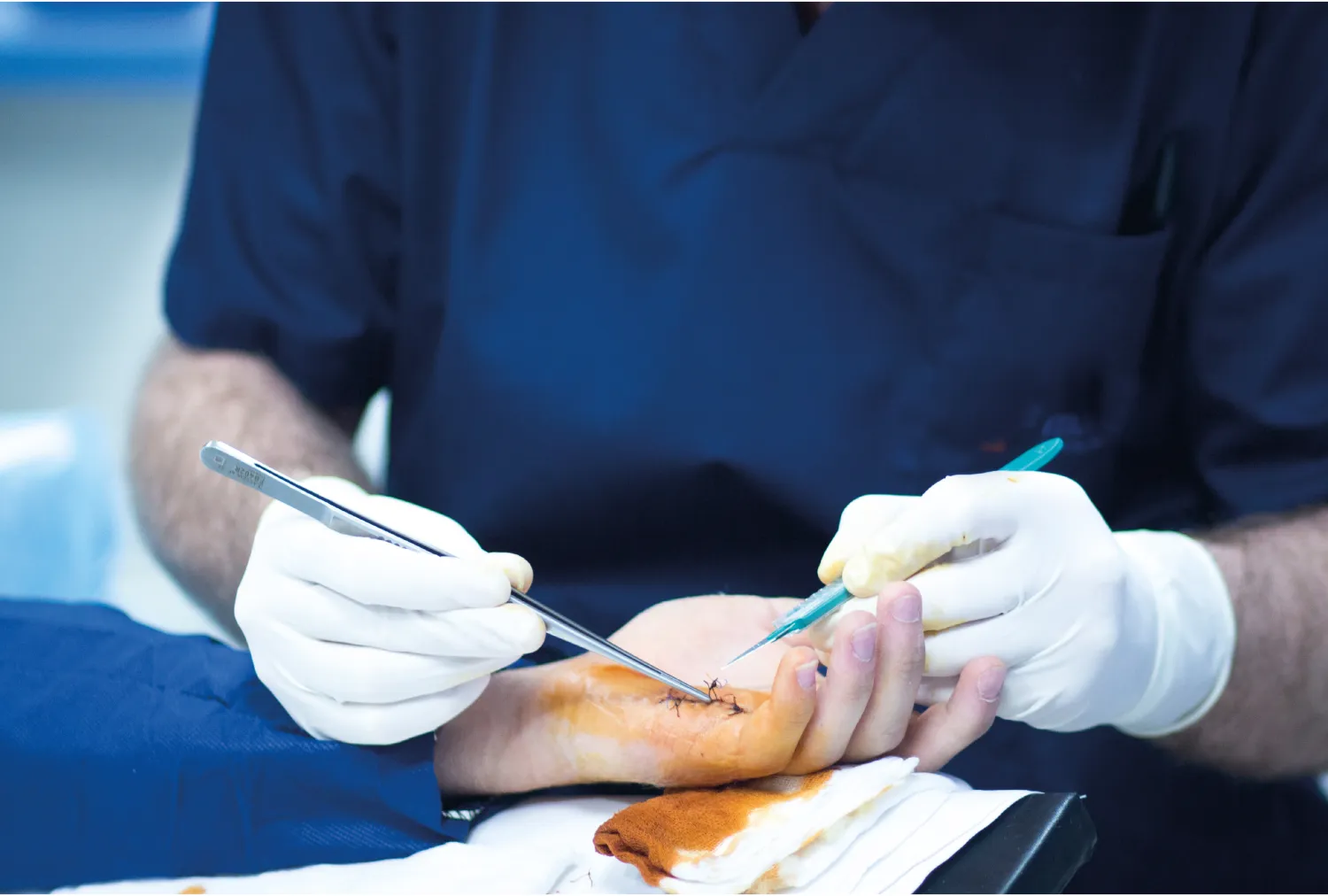 Blog Image - Hand Surgery — Treating Injuries, Deformities, and Nerve Damage